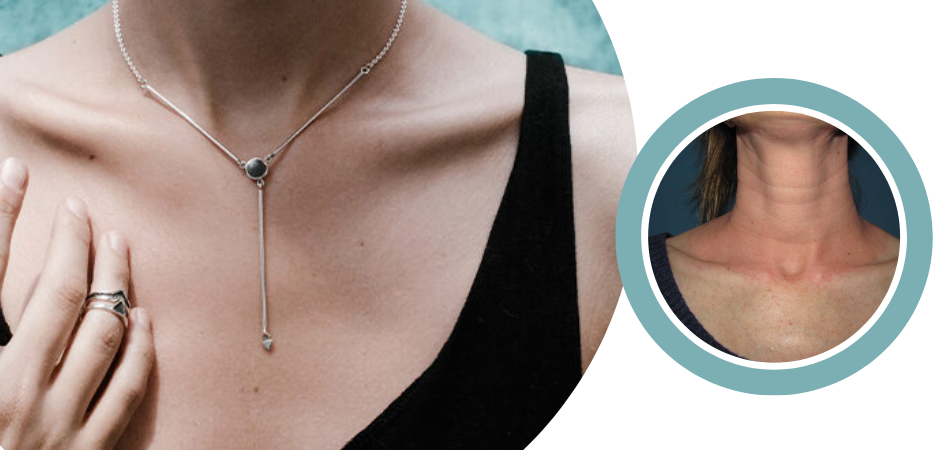 Can Wearing a Necklace Cause Wrinkles? – Fetchthelove Inc.