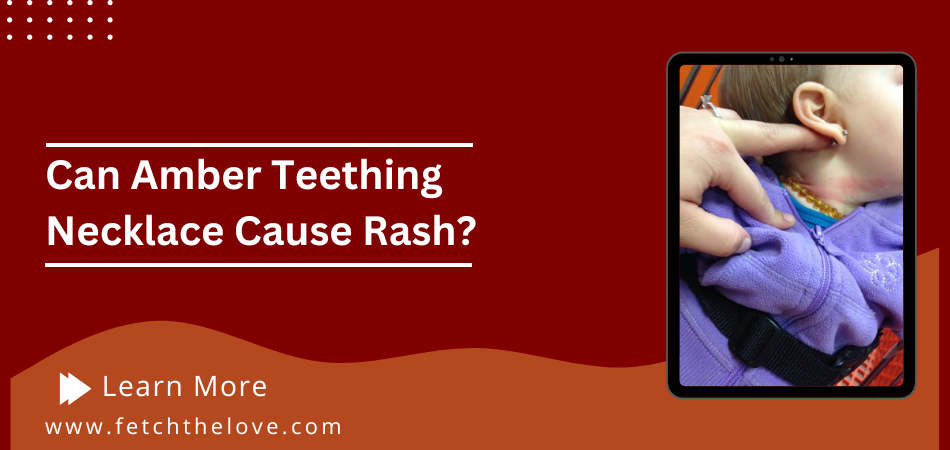 Can Amber Teething Necklace Cause Rash?