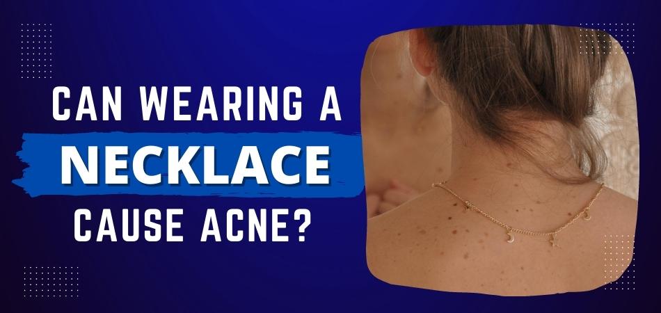 Can Wearing a Necklace Cause Acne?