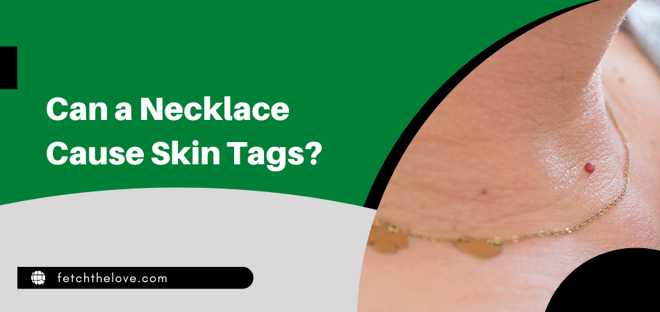 Can a Necklace Cause Skin Tags?